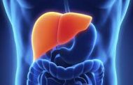 Hígado graso (no alcohólico), ¿cómo prevenirlo?