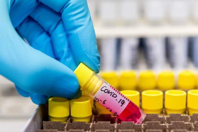 Colombia confirma primer caso de coronavirus COVID 19