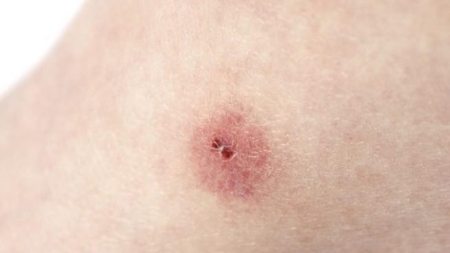 Fortalecer el cuidado en hogares para prevenir transmisión de Chagas durante la pandemia de Covid-19