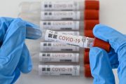 Secretarías de Salud a ejercer control y vigilancia con resultados de muestras del Covid-19