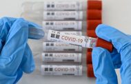 Secretarías de Salud a ejercer control y vigilancia con resultados de muestras del Covid-19