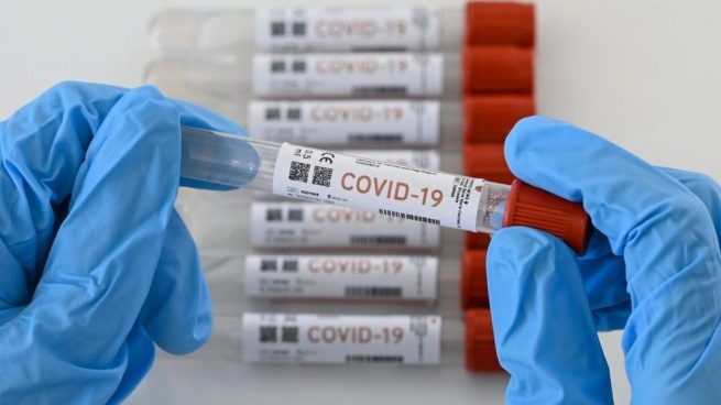 Secretarías de Salud a ejercer control y vigilancia con resultados de muestras del Covid-19