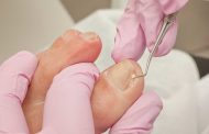 ¿Uñas encarnadas? Esto es lo que debes hacer