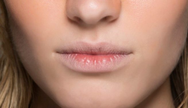 Por qué se agrietan los labios y cómo evitarlo