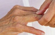 Qué es la artritis reumatoide, tratamiento y ejercicios