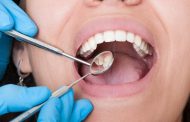Enfermedades de la boca: controlar, tratar, prevenir