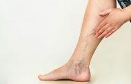 Cuando la neuropatía diabética afecta a las piernas y pies