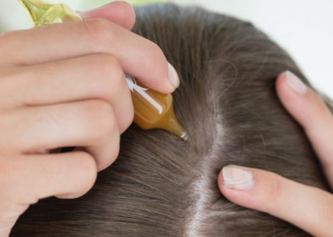 Qué remedios caseros ayudan a combatir la caída del cabello