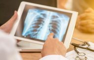 Minsalud asignó más de $ 7 mil ochocientos millones a programas de tuberculosis