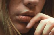 Por qué se agrietan los labios y cómo evitarlo