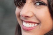 Qué es la sonrisa gingival y cómo se trata