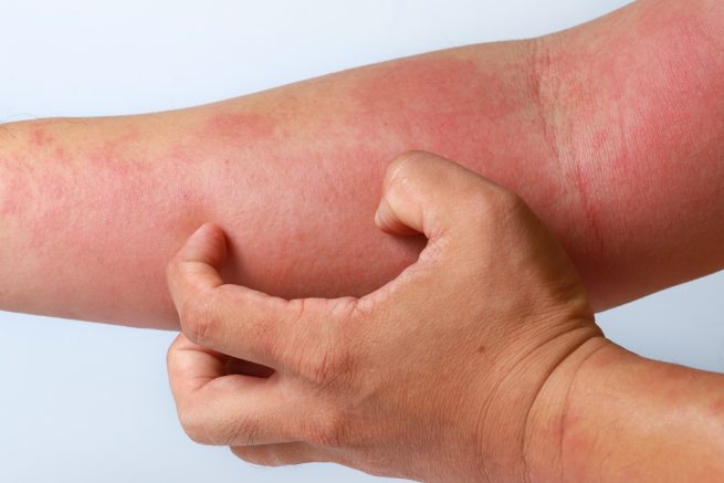 Todo sobre la piel: mitos y verdades sobre la salud cutánea