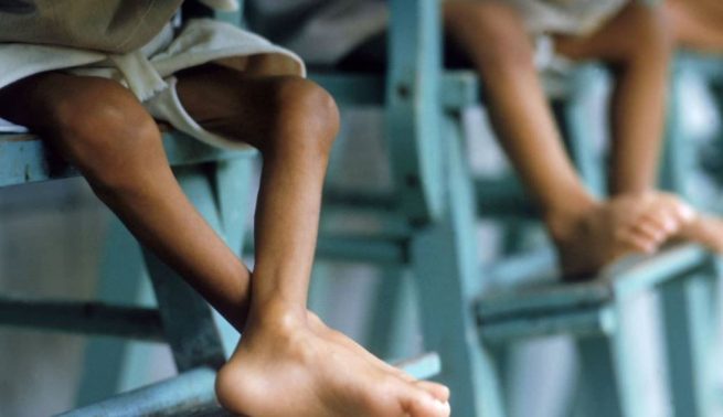 Preocupación por niños fallecidos por desnutrición en el Cesar