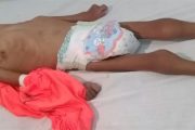 Procuraduría pide medidas urgentes para detener muertes por desnutrición en el país que alcanzan los 124 casos confirmados