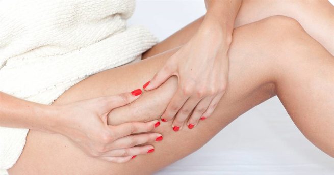 Qué es la celulitis y cómo se puede tratar en casa