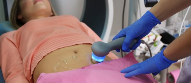 Dieta y estilo de vida para mujeres con ovario poliquístico