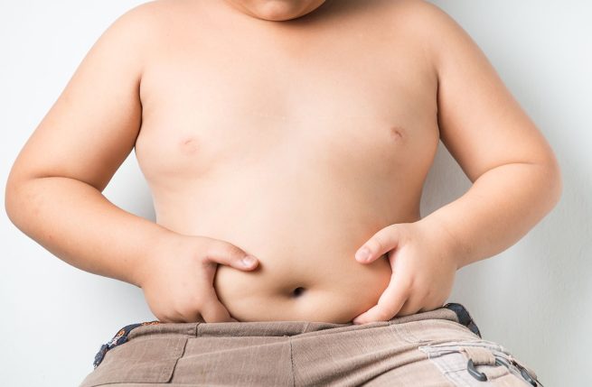 Controversia por nuevas guías para tratar la obesidad infantil
