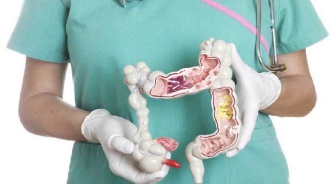 ¿Cómo saber si se tiene una infección por parásitos intestinales?