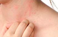 Qué se puede hacer para prevenir el cáncer de piel