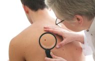 Cáncer de piel, uno de los más comunes en el mundo; ¿qué hacer y cómo evitarlo?