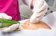 Biopsias, aliadas en la identificación de residuos de tejido cancerígeno de tiroides