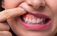 Estas son las sorprendentes razones por las cuales se te inflaman las encías