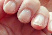 Esa descamación en las uñas tiene varias causas y no se trata solo de deshidratación