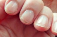 Esa descamación en las uñas tiene varias causas y no se trata solo de deshidratación