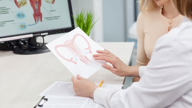 Los síntomas ginecológicos que podrían confundirse con los del cáncer
