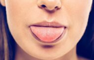 El color de tu lengua puede darte señales sobre tu salud