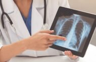 ¿Por qué el de pulmón es el cáncer que más mata en el mundo?