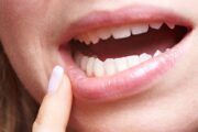 Qué dice la boca sobre la salud de nuestro cuerpo