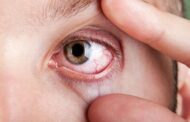 Estas tres enfermedades comunes pueden afectar gravemente la visión