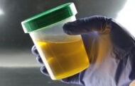 La ciencia responde por qué la orina es amarilla (y esto es lo dice el color acerca de nuestra salud)
