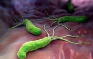 Infección por H. pylori y su relación con la úlcera péptica