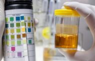 Qué significan los distintos colores de la orina