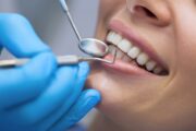 Existe una alarmante relación entre la placa dental y el cáncer colorrectal. De esto se trata
