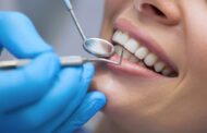 Existe una alarmante relación entre la placa dental y el cáncer colorrectal. De esto se trata