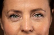 Párpado caído o 'ptosis' palpebral, algo más que un problema estético