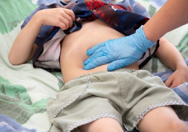 Enfermedad Inflamatoria Intestinal, afecta a más de 5 millones de personas