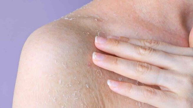 De la piel seca a los hongos: las 4 causas más frecuentes del picor en los pies, según los expertos