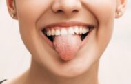 Lengua blanca: cuándo es normal y cuándo puede alertar de un problema de salud, según este médico