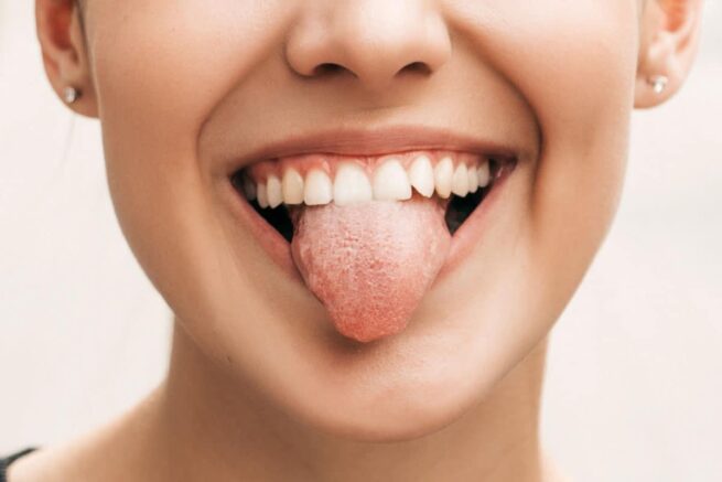 Lengua blanca: cuándo es normal y cuándo puede alertar de un problema de salud, según este médico